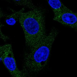TANK Antibody, Novus Biologicals 0.1mL; Unlabeled:Antibodies, Polyclonal